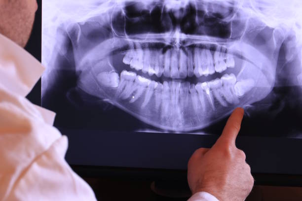 Best Emergency Denture Repair in Byrdstown, TN