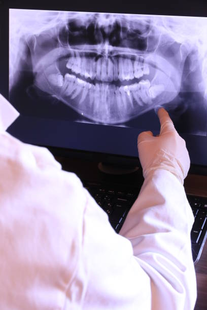 Best Emergency Tooth Extraction in Byrdstown, TN