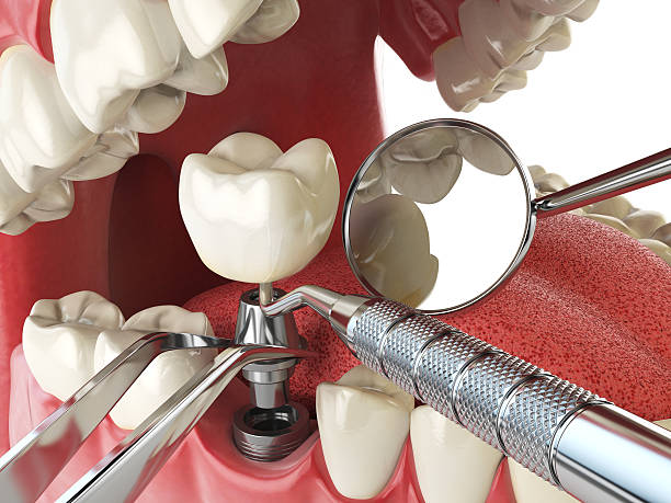 Best Same-Day Emergency Dental Services in Byrdstown, TN